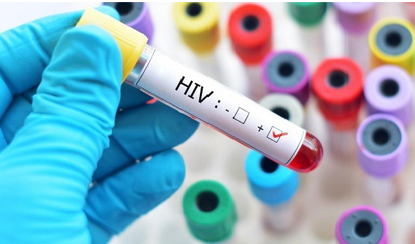 Içara acompanha em torno de 600 soropositivos de HIV