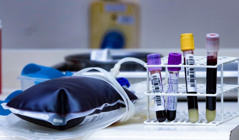 Da doação ao transplante, uma rede que pode salvar vidas