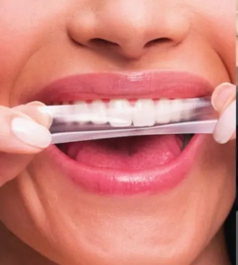 Venda de fitas de clareamento dental do TikTok é proibida pela Anvisa
