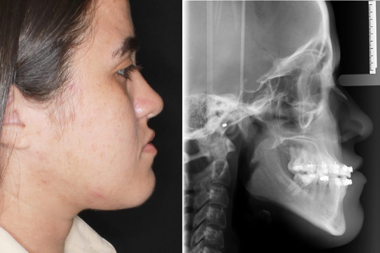 Há 18 anos na fila do SUS, moradora faz vakinha para cirurgia de R$ 56 mil