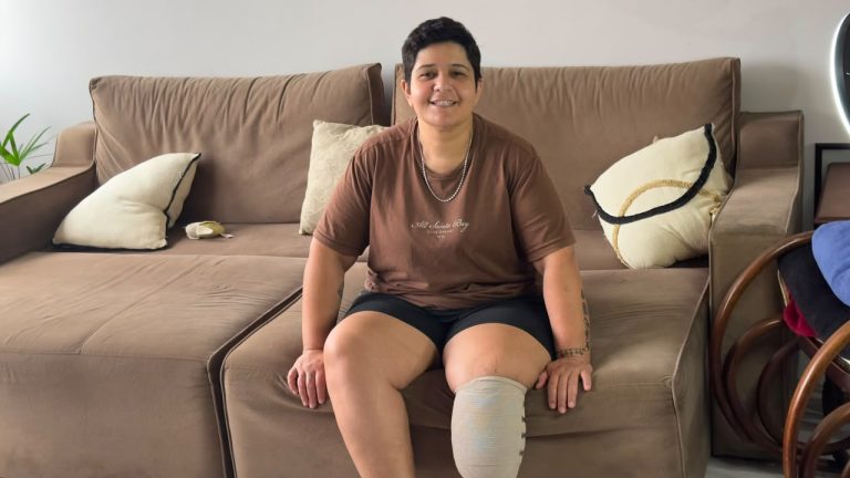 Após perder parte da perna por infecção, moradora de Criciúma busca apoio
