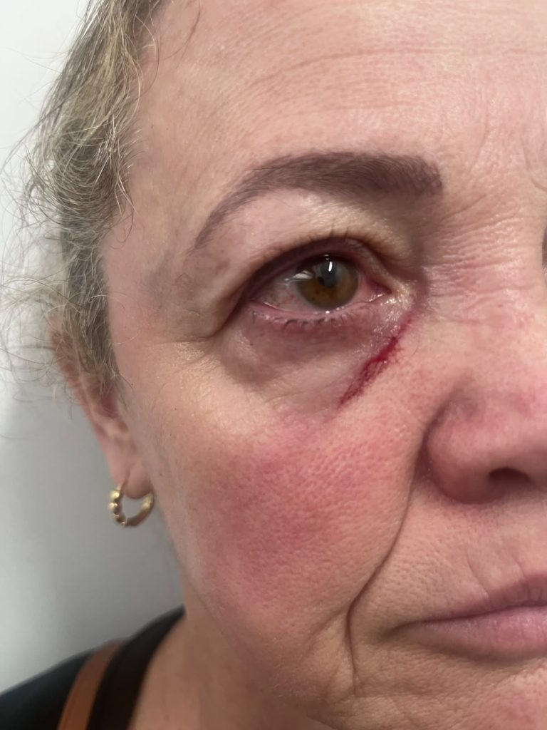 Professora é agredida por aluno em escola de Criciúma